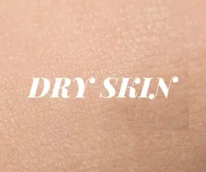 dry skin causes treatments